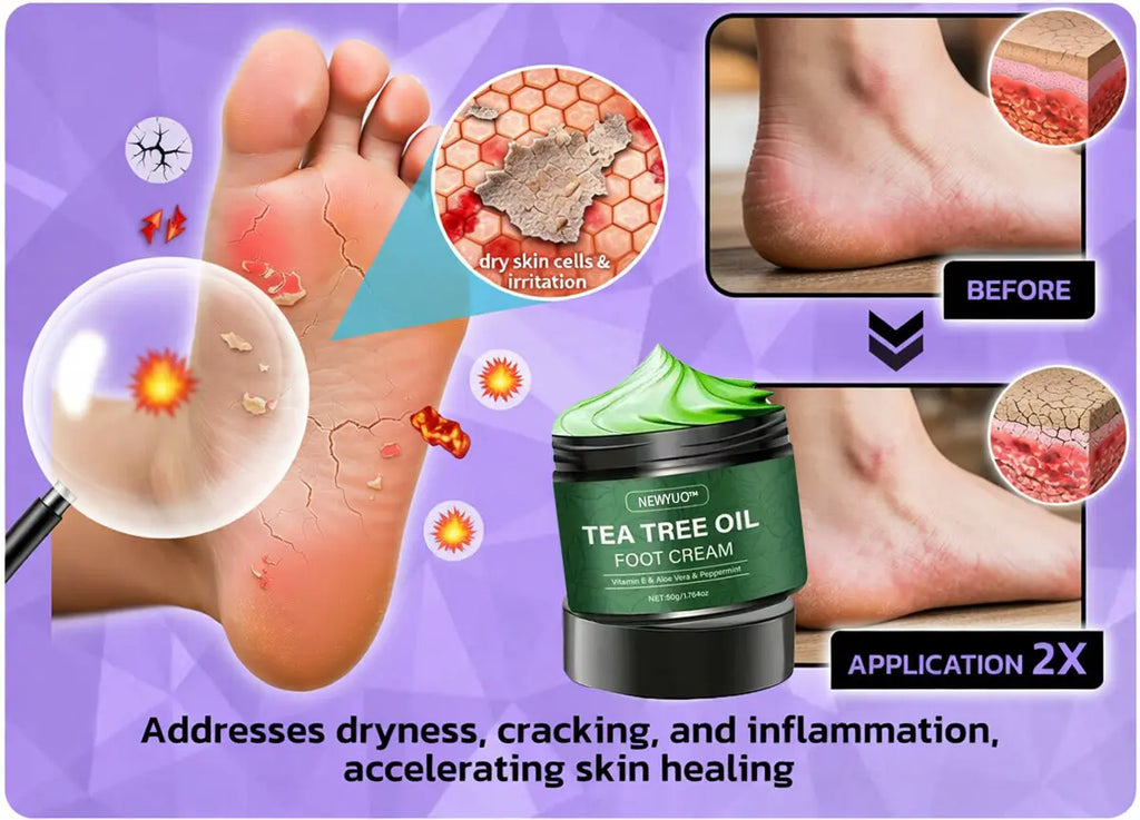 NEWYUOTM Tea Tree Oil Foot Cream