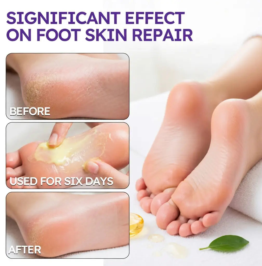 NEWYUOTM Tea Tree Oil Foot Cream