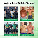 DOTALE® Metabolic Nano Microneedle Patch🎄(Just once a day, visible changes in 7 days）Berberine + Moringa Formula ✅ For obesity, Loose skin,diabetes, sleep apnea, joint issues, and more 💥💥